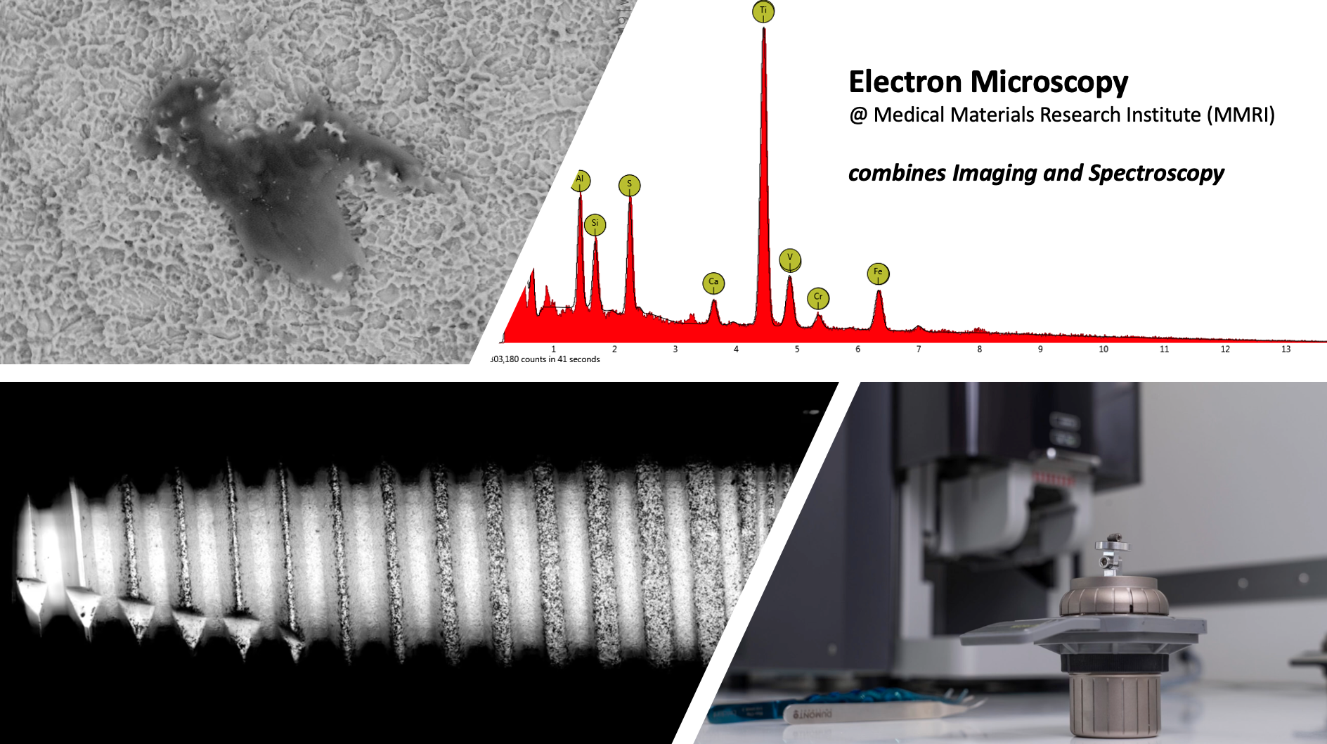 mmri-electron microscopy
